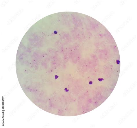 thick blood film identification